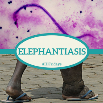 #IDFridays Week 14: Elephantiasis: https://www.drasatrust.org/elephantiasis/