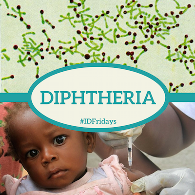 #IDFridays: Diphtheria