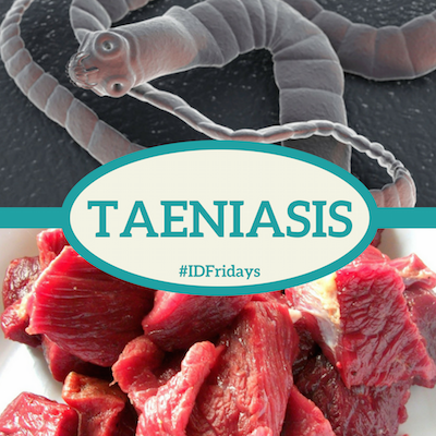 #IDFridays: Taeniasis 