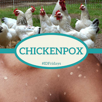 Chickenpox 200px