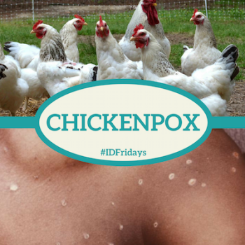 #IDFridays Week 45: Chickenpox: https://www.drasatrust.org/chickenpox/