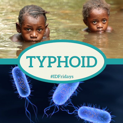 #IDFridays: Typhoid 