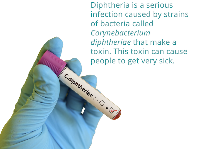 Diphtheria Outbreak 2023 Corynebacterium diphtheriae